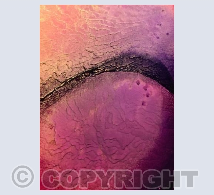 Abstract 2