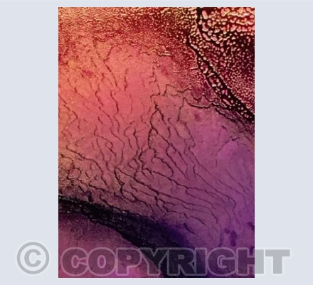 Abstract 4